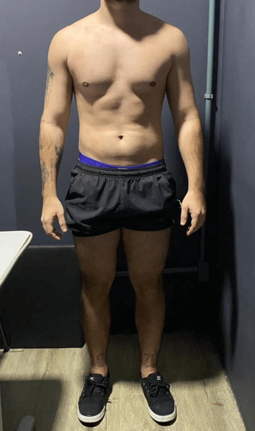 Antes