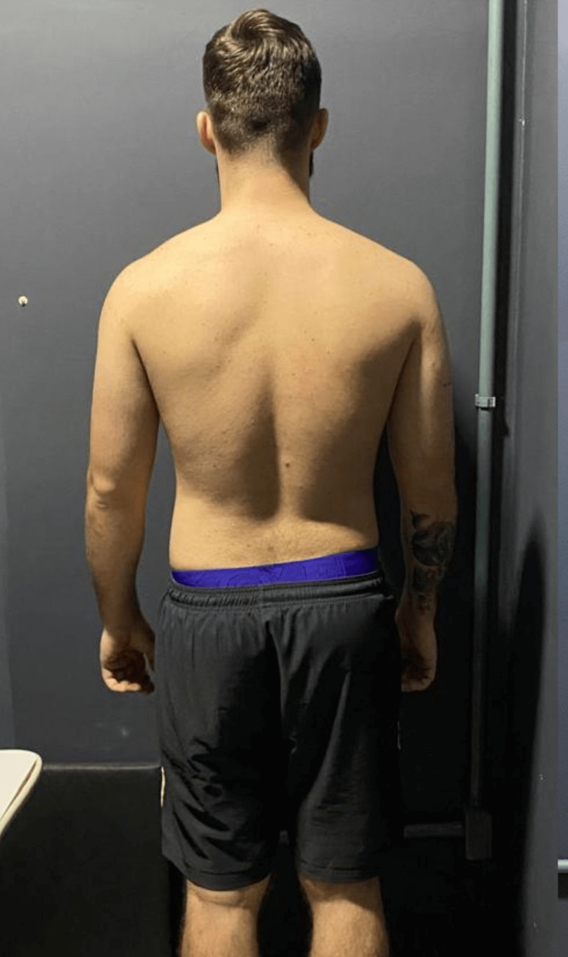 Antes